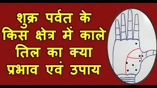 शुक्र पर्वत के किस क्षेत्र में काले तिल(Black Mole) का क्या प्रभाव एवं उपाय