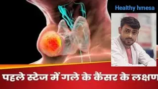 गले के कैंसर के शुरुआती लक्षण #larynxcancer #nackcancer