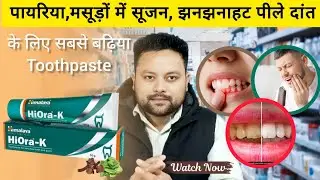 Pyria ke liye Sabse Best Toothpaste | 7 Din Me Bleeding Gums Band?