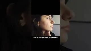 Facial kit for acne prone skin by glow up beauty #shorts #ytshorts #facialkit #skincare