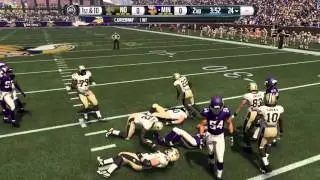 Madden 16   46 Normal   A Gap