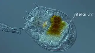 Rotifer: Notholca squamula