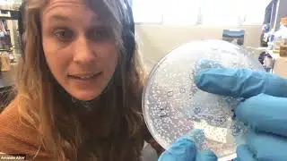 567L: Analyzing your Spread Plates and Learning to Streak Out Bacteria