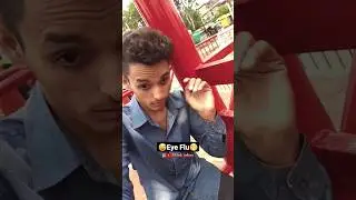 Eye Flu Hogya😅😁#shlokrohny #funny #shorts #trending