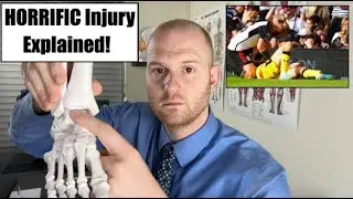 Chris Basham Injury Explained!  Chris Basham Ankle Injury