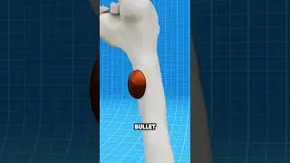 Femur Bone Vs Bullet