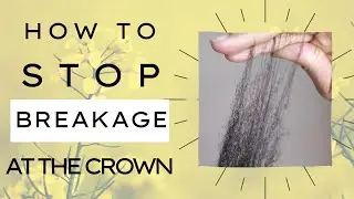 How to Stop Breakage In the Crown | Grow 4C Hair Long
