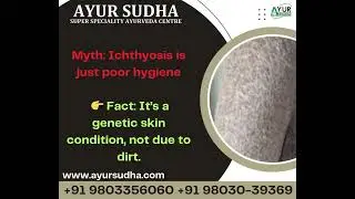 Ichthyosis  vulgaris