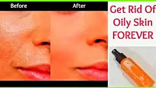 OILY FACE REMEDY-  Ladies Use This to stop Excess Oil on the Face get rid of spot~by Victoria Vick.