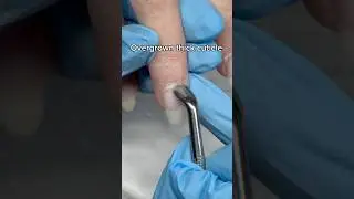 how to remove thick cuticle 💅 #drymanicure #nailtutorial #cuticle