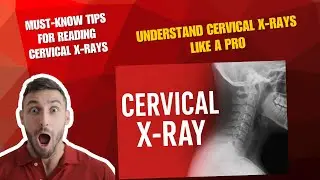 How to Read a Cervical Spine X-Ray in Urdu | Hindi