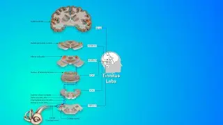 Почему бисенсорная нейромодуляция подходит не всем