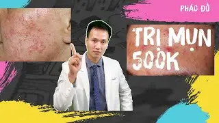Trị mụn tại nhà với 500k/tháng liệu có thành hiện thực cho các tín đồ Skincare | Dr Hiếu
