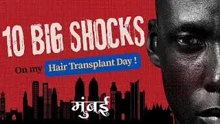 Best Hair Transplant in Mumbai | Best Cost of Hair Transplant Mumbai #hairtransplantinmumbai