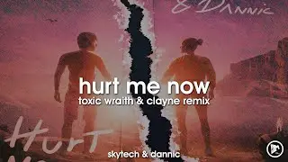 Skytech & Dannic - Hurt Me Now (Toxic Wraith & Clayne Remix)