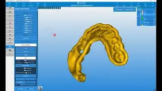 RealGUIDE Software:  Surgical Guide Modeling- Part 1