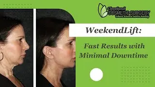 WeekendLift&trade;: Fast Results with Minimal Downtime