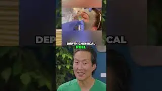 Better Than Phenol Peels: Get Glowing Skin with TCA Peels