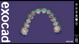 exocad Quick Guide: The 