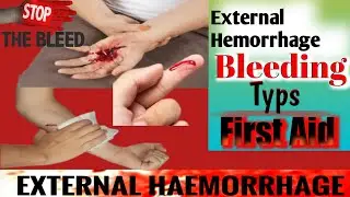 What Is Hemorrhage in Urdu | Hindi |First Aid At Home | @Nursingskills591