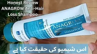 The Truth About Anagrow Anti Hair Fall Shampoo | Honest Review of Jenpharm anti-hair fall shampoo