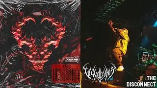 Vulvodynia - The Disconnect (Live in Leeds - Slamageddon EU/UK Tour)