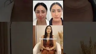 Facial harmonization also involves the eyebrows! If they are artificial, they will not match ⚠️