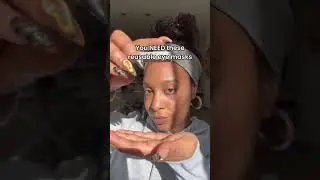 Under-eye dark circles?