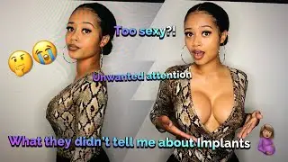 What they didn't tell me about Implants!