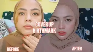 HOW TO COVER MY BIRTHMARK ( Cara Menutupi Tanda lahir dengan Makeup ) #thepowerofmakeup