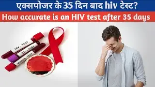How accurate is an HIV test after 35 days of exposure exposure?पैतीस दिनों के बाद एचआईवी परीक्षण?