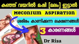 Why Baby Pass Meconium in the Womb|Complications of Pregnancy