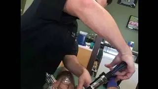 What Acupuncture and Dynamic Cupping can do for Your Recovery