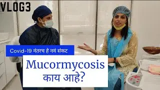 what is mucormycosis? Vlog no.3