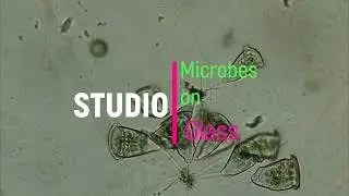 Эолосома. Aeolosoma hemprichi. Абсолютно безопасный для рыбок и креветок червь в аквариуме.