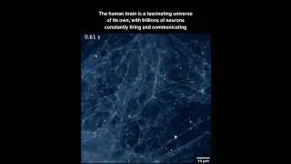 The Human Brain &ndash; A Universe of Its Own!