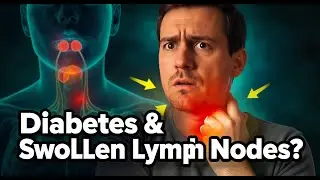 Can Diabetes Cause Swollen Lymph Nodes in Your Neck