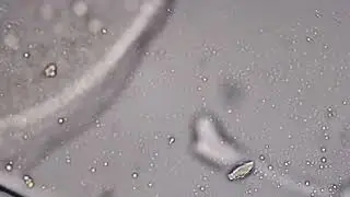 Living human blood under microscope 100x magnification