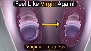 Restore Your Vaginal Tightness After Childbirth | 3D Animated | Expert Tips & Hacks |