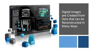 Digital X-ray Creating Medical Images