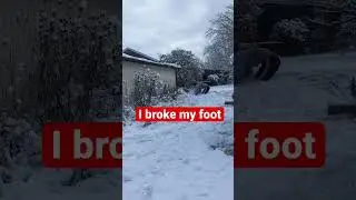 I BROKE MY ARM