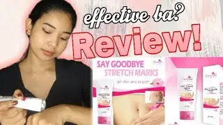Stretchmark Remover Cream by Beauty Lab Essentials | SHORT REVIEW!