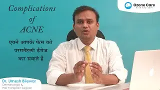 Complications of Acne | एक्ने आपके फेस को परमानैंटली डैमेज कर सकते है |Ozone Care Hair & Skin Clinic