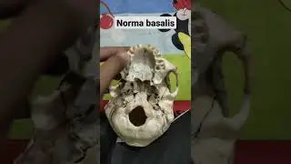 NORMA BASALIS IDENTIFICATION...PLEASE SUBSCRIBE