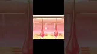 In 60 Sekunden erkl&auml;rt ! Wie funktioniert die dauerhafte Haarentfernung mit dem Laser ? #shorts