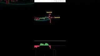 Most Accurate Sniper Entry Techniques For Scalping #shorts #trading #forex #crypto #scalping