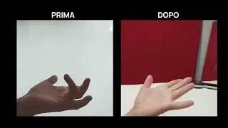 Evidenza Clinica ENF therapy - Dito a scatto