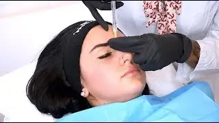Dr. Natalie Keller – Nasenkorrektur mit Hyaluronsäure, Lippen und Tränenrinne, Osnabrück