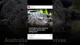 Crocodile Attack Survivor! #australia #attack  #crocodile
