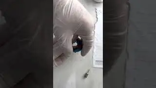Moldagem de protocolo inferior com guia cir&uacute;rgico ( envio para o laborat&oacute;rio)